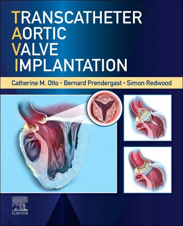 Transcatheter Aortic Valve Implantation, ebook
