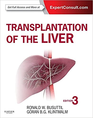 Transplantation of the Liver ebook