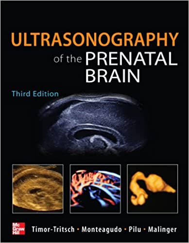 Ultrasonography of the Prenatal Brain, Third Edition ebook