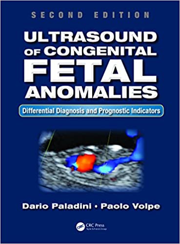 Ultrasound of Congenital Fetal Anomalies: Differential Diagnosis and Prognostic Indicators, Second Edition ebook