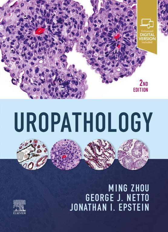 Uropathology, 2nd Edition ebook