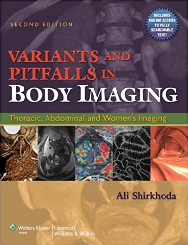 Variants and Pitfalls in Body Imaging: Thoracic, Abdominal and Women's Imaging ebook