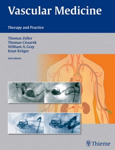 Vascular Medicine Therapy and Practice 2nd Edition by Thomas Zeller ebook