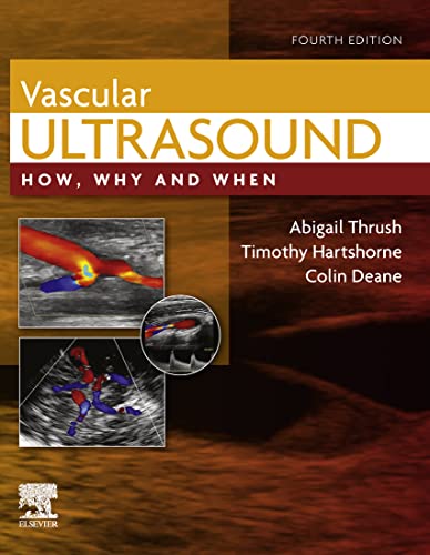Vascular Ultrasound: How, Why and When, 4th Edition ebook
