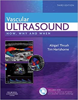 Vascular Ultrasound: How, Why and When ebook