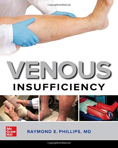 Venous Insufficiency ebook