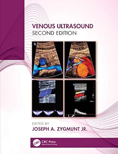 Venous Ultrasound, 2nd Edition ebook