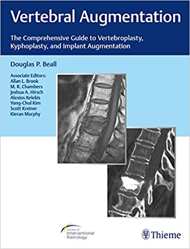 Vertebral Augmentation: The Comprehensive Guide to Vertebroplasty, Kyphoplasty, and Implant Augmentation ebook