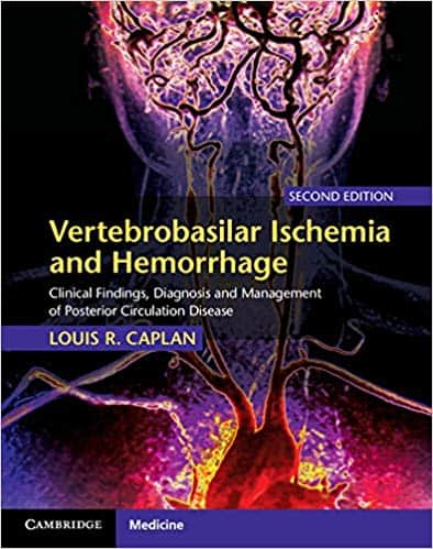 Vertebrobasilar Ischemia and Hemorrhage: Clinical Findings, Diagnosis and Management of Posterior Circulation Disease (2nd Edition) ? ebook