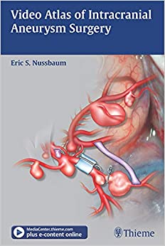 Video Atlas of Intracranial Aneurysm Surgery ebook