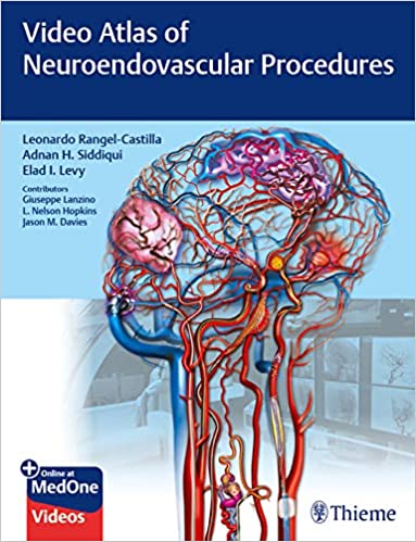Video Atlas of Neuroendovascular Procedures ebook