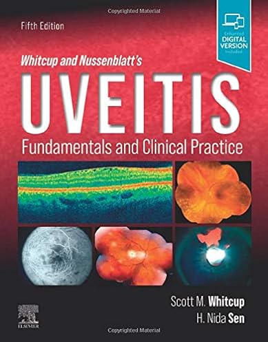 Whitcup and Nussenblatt's Uveitis,: Fundamentals and Clinical Practice, 5th Edition ebook