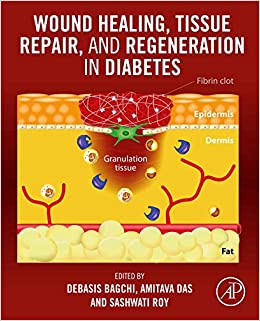 Wound Healing, Tissue Repair, and Regeneration in Diabetes ebook