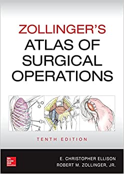Zollinger's Atlas of Surgical Operations, 10th edition ebook